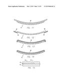 Flexible Circuit Electrode Array Embedded in a Cured Body diagram and image