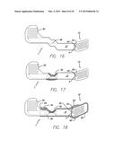 Flexible Circuit Electrode Array Embedded in a Cured Body diagram and image