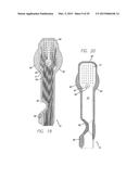 Flexible Circuit Electrode Array Embedded in a Cured Body diagram and image