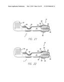 Flexible Circuit Electrode Array Embedded in a Cured Body diagram and image