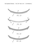 Flexible Circuit Electrode Array Embedded in a Cured Body diagram and image