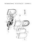 Construction for an Implantable Medical Device Employing an Internal     Support Structure diagram and image