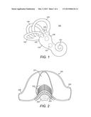 Fenestration Electrode to Treat Patients with Meniere s Disease diagram and image