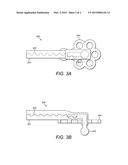 Fenestration Electrode to Treat Patients with Meniere s Disease diagram and image