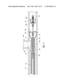 DELIVERY OF MEDICAL DEVICES diagram and image