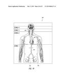 DELIVERY OF MEDICAL DEVICES diagram and image