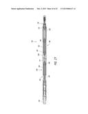 DELIVERY OF MEDICAL DEVICES diagram and image