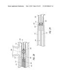 DELIVERY OF MEDICAL DEVICES diagram and image