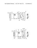 PROSTHESIS, SYSTEM AND METHOD diagram and image