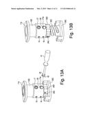 PROSTHESIS, SYSTEM AND METHOD diagram and image