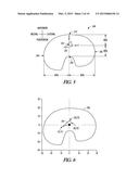 METHOD FOR OPTIMIZING IMPLANT DESIGNS diagram and image