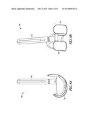 METHOD FOR OPTIMIZING IMPLANT DESIGNS diagram and image