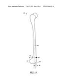 METHOD FOR OPTIMIZING IMPLANT DESIGNS diagram and image