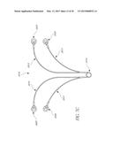 INTRAUTERINE DEVICE diagram and image