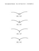 INTRAUTERINE DEVICE diagram and image