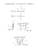 INTRAUTERINE DEVICE diagram and image