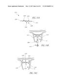 INTRAUTERINE DEVICE diagram and image