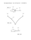 INTRAUTERINE DEVICE diagram and image