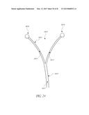 INTRAUTERINE DEVICE diagram and image