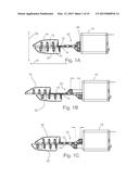 APPARATUSES AND METHODS FOR MANDIBULAR PROTRUSION diagram and image