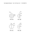 SYSTEMS AND METHODS FOR ANESTHETIZING EAR TISSUE diagram and image