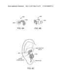 SYSTEMS AND METHODS FOR ANESTHETIZING EAR TISSUE diagram and image