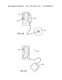 SYSTEMS AND METHODS FOR ANESTHETIZING EAR TISSUE diagram and image