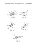 SYSTEMS AND METHODS FOR ANESTHETIZING EAR TISSUE diagram and image