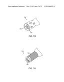 SYSTEMS AND METHODS FOR ANESTHETIZING EAR TISSUE diagram and image