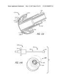 SYSTEMS AND METHODS FOR ANESTHETIZING EAR TISSUE diagram and image