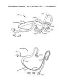 SYSTEMS AND METHODS FOR ANESTHETIZING EAR TISSUE diagram and image