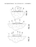 APPARATUS FOR REMOVING IMPURITIES FROM WATER OR WASTEWATER AND A METHOD OF     INSTALLING A FLUID DISTRIBUTION SYSTEM THEREIN diagram and image