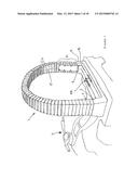 FLEXIBLE IMPACT PROTECTION diagram and image