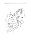 FLEXIBLE IMPACT PROTECTION diagram and image