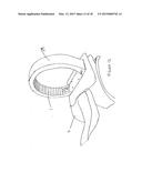 FLEXIBLE IMPACT PROTECTION diagram and image