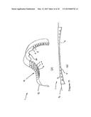 FLEXIBLE IMPACT PROTECTION diagram and image