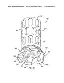 EXHAUST MIXING DEVICE diagram and image