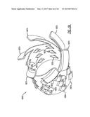 AXIAL FLOW ATOMIZATION MODULE WITH MIXING DEVICE diagram and image