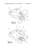 Elastic Band Retention System diagram and image