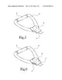 Elastic Band Retention System diagram and image