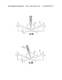 SYSTEM FOR MYOMECTOMY AND MORCELLATION diagram and image