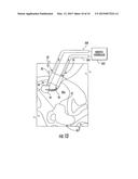 SYSTEM FOR MYOMECTOMY AND MORCELLATION diagram and image