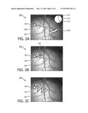 GUIDANCE TOOLS TO MANUALLY STEER ENDOSCOPE USING PRE-OPERATIVE AND     INTRA-OPERATIVE 3D IMAGES diagram and image
