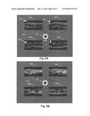 SYSTEMS AND METHODS FOR SELECTION AND DISPLAYING OF IMAGES USING AN     INTRAVASCULAR ULTRASOUND IMAGING SYSTEM diagram and image