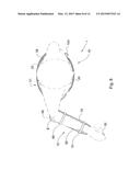 DYNAMIC SHOULDER ORTHOSIS WITH REHABILITATING ADDUCTION diagram and image