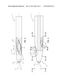 Catheter Assembly diagram and image