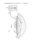 NEGATIVE PRESSURE THERAPY WITH DYNAMIC PROFILE CAPABILITY diagram and image