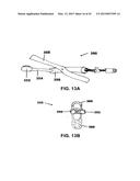 METHODS AND DEVICES TO TREAT NASAL AIRWAYS diagram and image