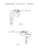 NATIVE VERSION ALIGNMENT DEVICES AND METHODS diagram and image