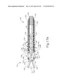 SURGICAL CLIP APPLIER WITH ARTICULATION SECTION diagram and image